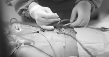 Traitement orthopédique du thorax en carène