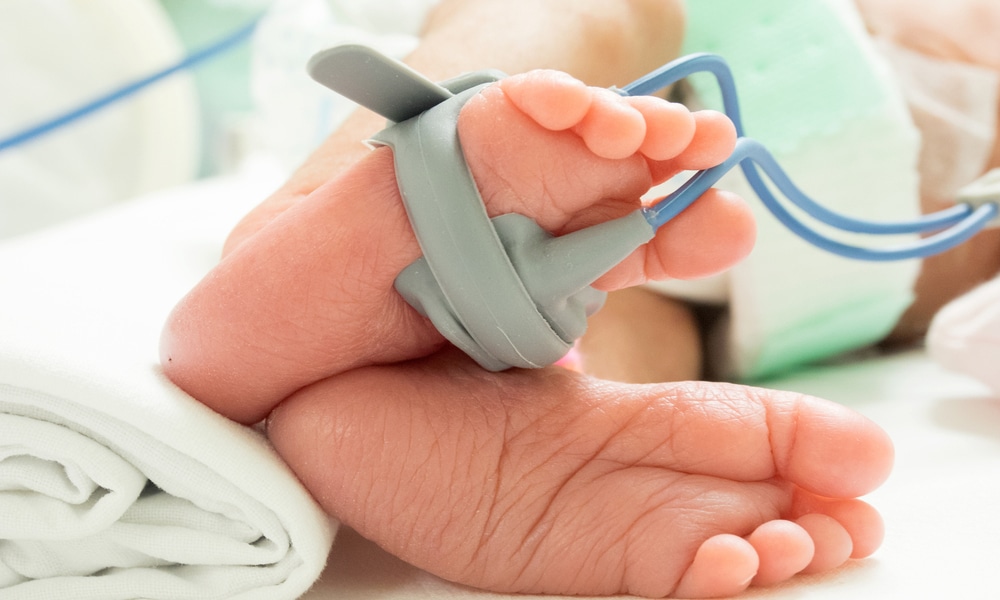Mesure de la saturation pulsée en oxygène en pédiatrie : clés pour  l'interprétation - Réalités Pédiatriques