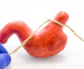 Chirurgie bariatrique chez l’adolescent : les bonnes et mauvaises indications