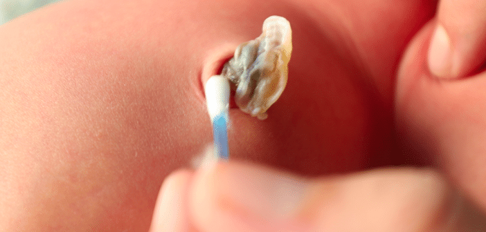 Les soins du cordon en 2025 en France : quelles pratiques basées sur les preuves faut-il recommander aux nouveaux parents ?