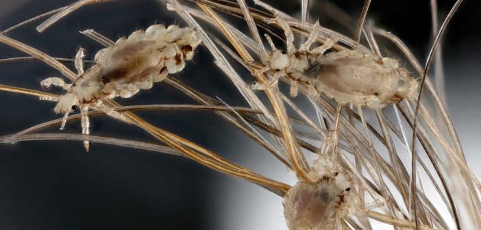 Pédiculose : quoi de neuf ?