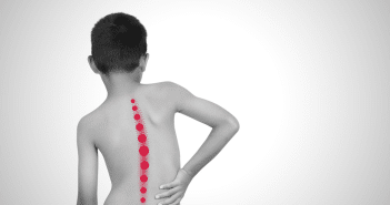 La scoliose idiopathique de l’adolescent