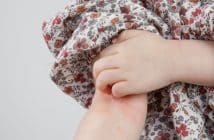 Urticaire de l'enfant