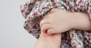 Urticaire de l'enfant