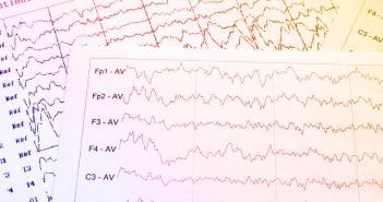 Que faire devant une première crise convulsive chez l’enfant ?