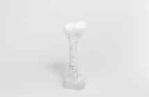 Ostéite chronique récurrente multifocal  : quand l’évoquer et que faire ?