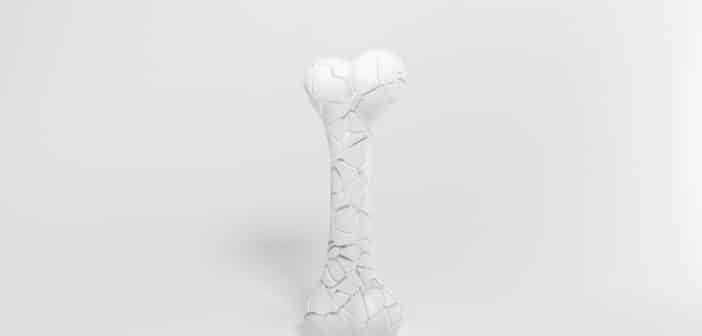 Ostéite chronique récurrente multifocal  : quand l’évoquer et que faire ?