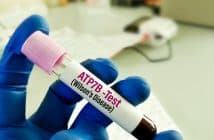 Traitement de la maladie de Wilson chez l’enfant