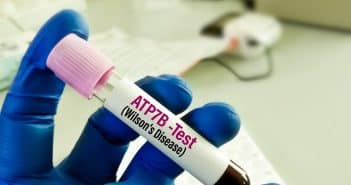 Traitement de la maladie de Wilson chez l’enfant