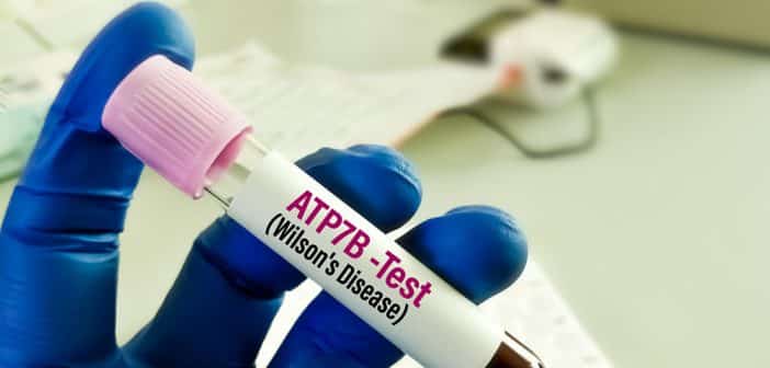 Traitement de la maladie de Wilson chez l’enfant