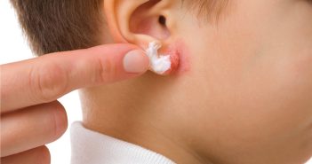 Eczéma de contact : se méfier des formes trompeuses